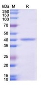 SDS-PAGE (XRCC1-6578H).jpg